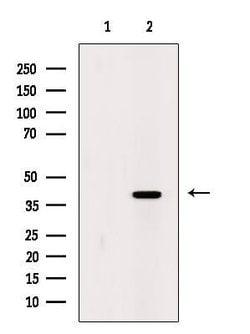 Invitrogen CCR4 Polyclonal Antibody 100 &mu;L; Unconjugated:Antibodies,