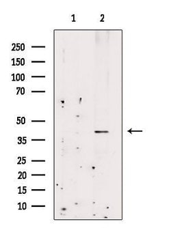Invitrogen CCR4 Polyclonal Antibody 100 &mu;L; Unconjugated:Antibodies,