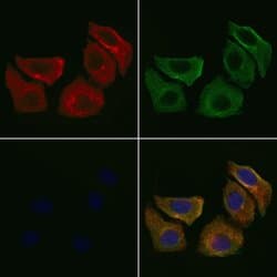 Invitrogen PTGER1 Polyclonal Antibody 100 &mu;L; Unconjugated:Antibodies,