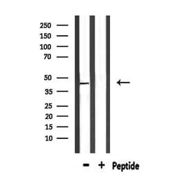 Invitrogen PTGER1 Polyclonal Antibody 100 &mu;L; Unconjugated:Antibodies,