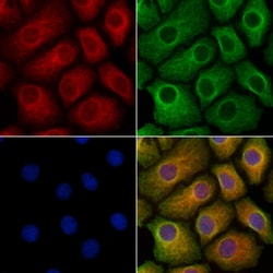 Invitrogen GPR179 Polyclonal Antibody 100 &mu;L; Unconjugated:Antibodies,