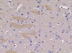 Invitrogen GPR179 Polyclonal Antibody 100 &mu;L; Unconjugated:Antibodies,