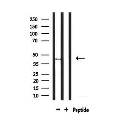 Invitrogen GPR85 Polyclonal Antibody 100 &mu;L; Unconjugated:Antibodies,
