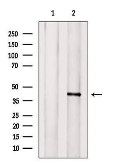 Invitrogen GPR85 Polyclonal Antibody 100 &mu;L; Unconjugated:Antibodies,