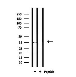 Invitrogen OR4C46 Polyclonal Antibody 100 &mu;L | Buy Online | Invitrogen&trade; | Fisher Scientific