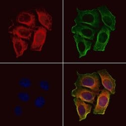 Invitrogen OR52E6/OR52E8 Polyclonal Antibody 100 &mu;L | Buy Online | Invitrogen&trade; | Fisher Scientific