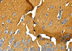 Invitrogen OR52E6/OR52E8 Polyclonal Antibody 100 &mu;L | Buy Online | Invitrogen&trade; | Fisher Scientific