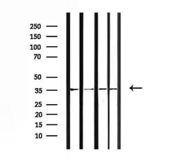 Invitrogen OR52E6/OR52E8 Polyclonal Antibody 100 &mu;L | Buy Online | Invitrogen&trade; | Fisher Scientific