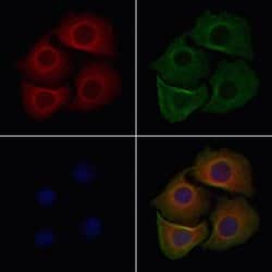 Invitrogen OR14A16 Polyclonal Antibody 100 &mu;L; Unconjugated:Antibodies,