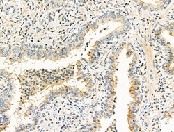 Invitrogen Opsin Blue Polyclonal Antibody 100 &mu;L; Unconjugated:Antibodies,