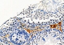 Invitrogen OR12D2 Polyclonal Antibody 100 &mu;L; Unconjugated:Antibodies,