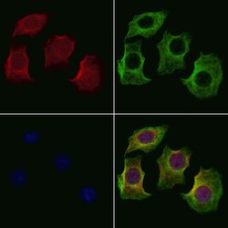 Invitrogen OR1K1 Polyclonal Antibody 100 &mu;L; Unconjugated:Antibodies,