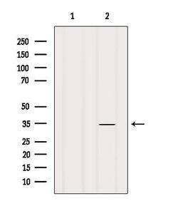 Invitrogen OR1K1 Polyclonal Antibody 100 &mu;L; Unconjugated:Antibodies,