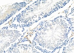 Invitrogen OR2T4 Polyclonal Antibody 100 &mu;L | Buy Online | Invitrogen&trade; | Fisher Scientific