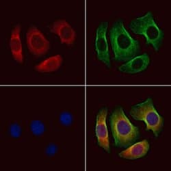 P2Y10 Polyclonal Antibody:Antibodies, Polyclonal