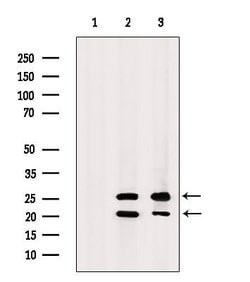 Invitrogen TAS2R41 Polyclonal Antibody 100 &mu;L | Buy Online | Invitrogen&trade; | Fisher Scientific