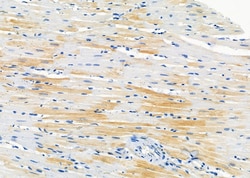 Invitrogen TAS2R40 Polyclonal Antibody 100 &mu;L; Unconjugated:Antibodies,