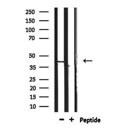 Invitrogen TAS2R40 Polyclonal Antibody 100 &mu;L; Unconjugated:Antibodies,