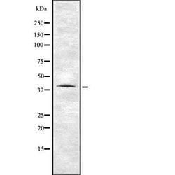 Invitrogen VN1R1 Polyclonal Antibody 100 &mu;L; Unconjugated:Antibodies,