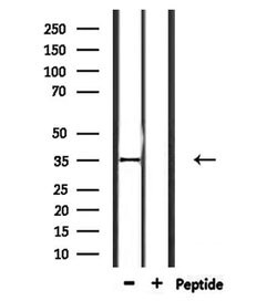 Invitrogen OR2L2 Polyclonal Antibody 100 &mu;L; Unconjugated:Antibodies,