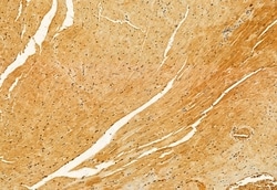 IFT88 Polyclonal Antibody:Antibodies, Polyclonal