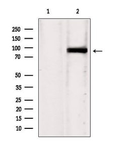 IFT88 Polyclonal Antibody:Antibodies, Polyclonal