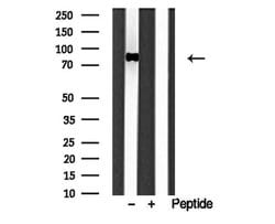 IFT88 Polyclonal Antibody:Antibodies, Polyclonal