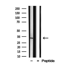 Invitrogen C2orf33 Polyclonal Antibody 100 &mu;L; Unconjugated:Antibodies,