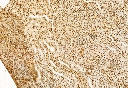 Invitrogen SHARPIN Polyclonal Antibody 100 &mu;L | Buy Online | Invitrogen&trade; | Fisher Scientific