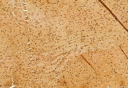 Invitrogen SHARPIN Polyclonal Antibody 100 &mu;L | Buy Online | Invitrogen&trade; | Fisher Scientific