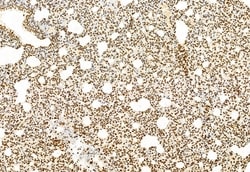 Invitrogen SHARPIN Polyclonal Antibody 100 &mu;L | Buy Online | Invitrogen&trade; | Fisher Scientific