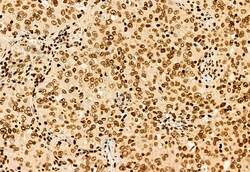 Invitrogen SHARPIN Polyclonal Antibody 100 &mu;L | Buy Online | Invitrogen&trade; | Fisher Scientific