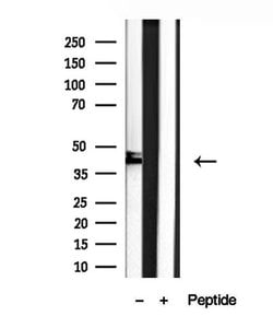 Invitrogen SHARPIN Polyclonal Antibody 100 &mu;L | Buy Online | Invitrogen&trade; | Fisher Scientific