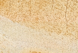 Invitrogen CNOT1 Polyclonal Antibody 100 &mu;L; Unconjugated:Antibodies,