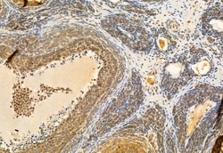 Invitrogen CNOT1 Polyclonal Antibody 100 &mu;L; Unconjugated:Antibodies,