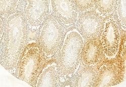 Invitrogen CNOT1 Polyclonal Antibody 100 &mu;L; Unconjugated:Antibodies,