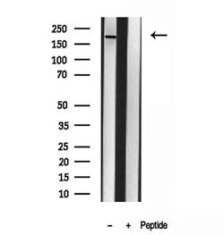 Invitrogen CNOT1 Polyclonal Antibody 100 &mu;L; Unconjugated:Antibodies,