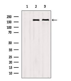 Invitrogen CNOT1 Polyclonal Antibody 100 &mu;L; Unconjugated:Antibodies,
