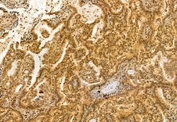 Invitrogen VPRBP Polyclonal Antibody 100 &mu;L; Unconjugated:Antibodies,
