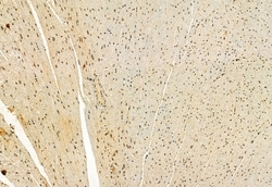Invitrogen VPRBP Polyclonal Antibody 100 &mu;L; Unconjugated:Antibodies,