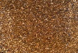 Invitrogen VPRBP Polyclonal Antibody 100 &mu;L; Unconjugated:Antibodies,