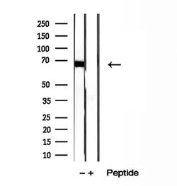 Invitrogen ADAM12 Polyclonal Antibody 100 &mu;L; Unconjugated:Antibodies,