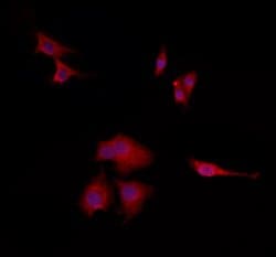 Invitrogen TPI1 Polyclonal Antibody 100 &mu;L; Unconjugated:Antibodies,