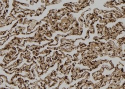 Invitrogen TPI1 Polyclonal Antibody 100 &mu;L; Unconjugated:Antibodies,
