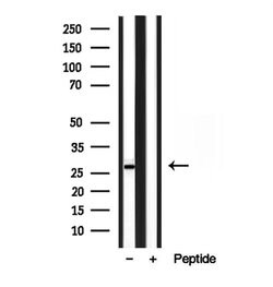 Invitrogen TPI1 Polyclonal Antibody 100 &mu;L; Unconjugated:Antibodies,