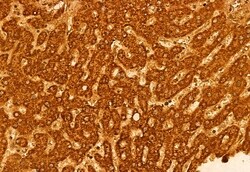 Invitrogen ECHS1 Polyclonal Antibody 100 &mu;L; Unconjugated:Antibodies,