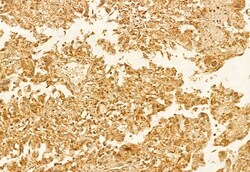 Invitrogen ECHS1 Polyclonal Antibody 100 &mu;L; Unconjugated:Antibodies,