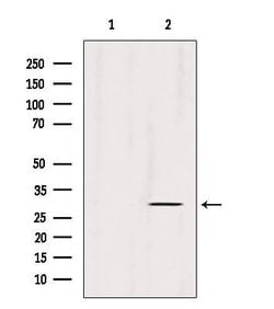 Invitrogen ECHS1 Polyclonal Antibody 100 &mu;L; Unconjugated:Antibodies,