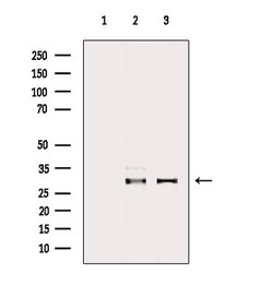 Invitrogen ECHS1 Polyclonal Antibody 100 &mu;L; Unconjugated:Antibodies,