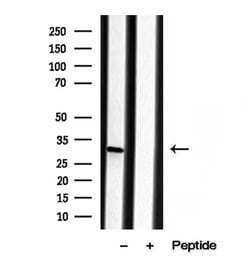 Invitrogen ECHS1 Polyclonal Antibody 100 &mu;L; Unconjugated:Antibodies,